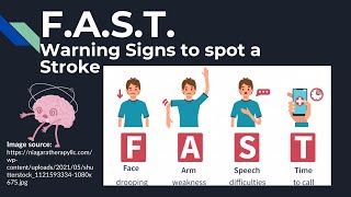 Recognize the signs of stroke FAST | F.A.S.T. Signs of Stroke | Novice Medic
