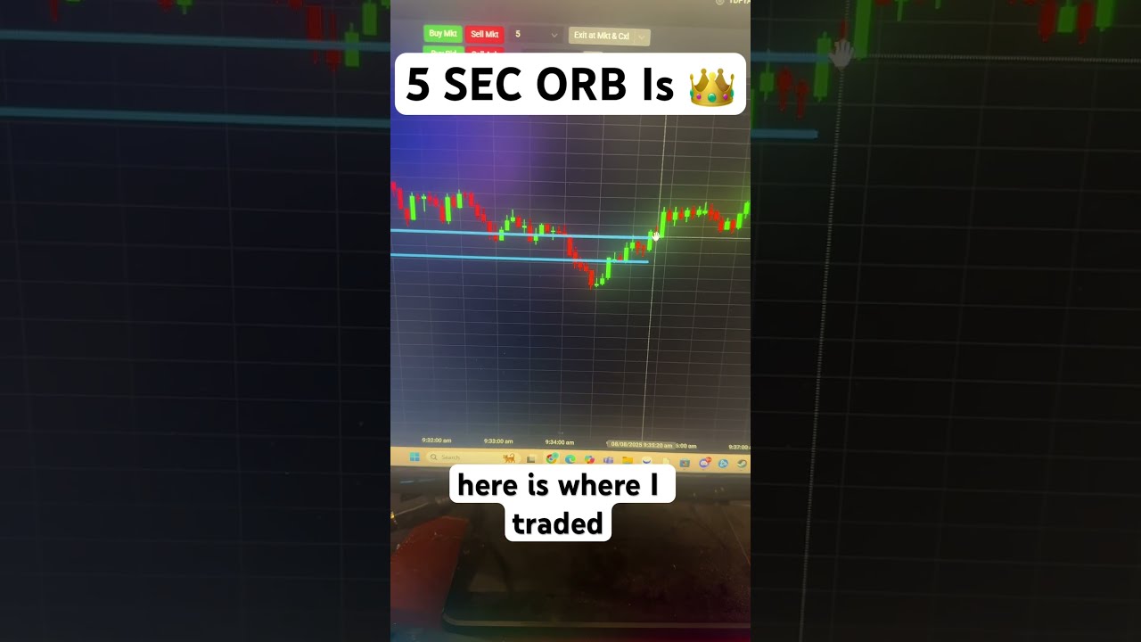 5 SEC ORB Is Making Bank Learn This Futures Strat Trading Daytrading Daytrader