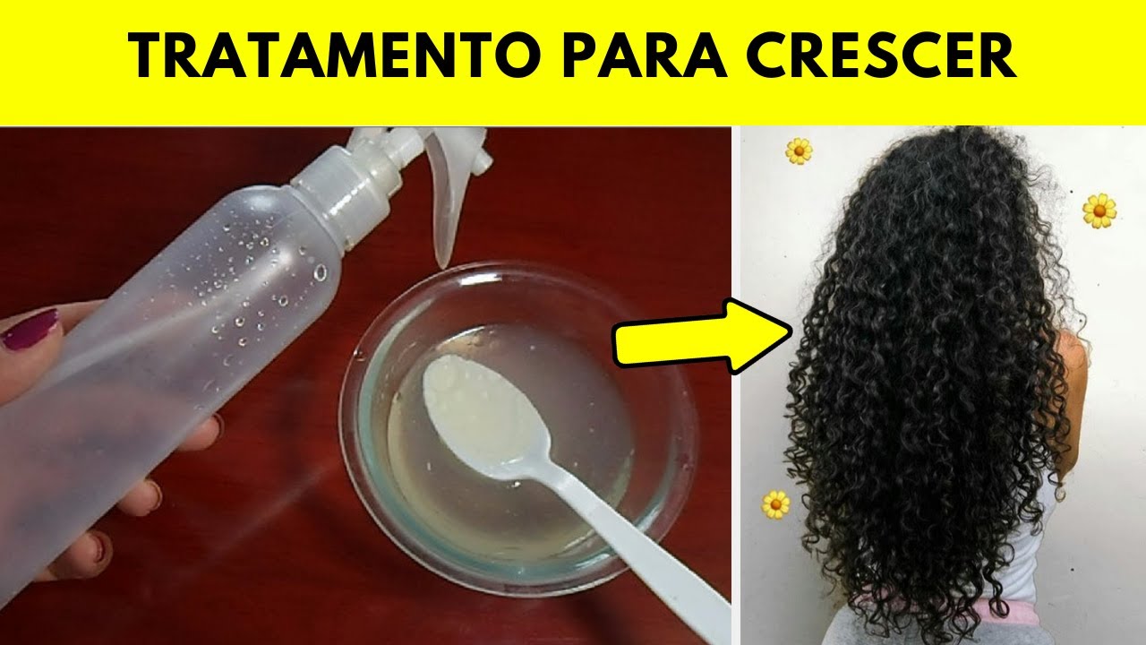 Remédio Caseiro Para Ardência No Couro Cabeludo - RETOEDU
