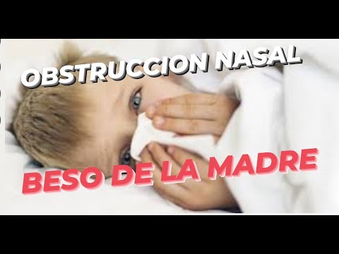 Truco para desobstruir la NARIZ de un niño[ Beso de la Madre]