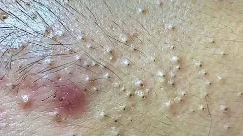 Satisfying video  with Chung Vo Spa #138