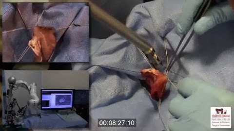 STAR Robot for “Soft Tissue” Surgery