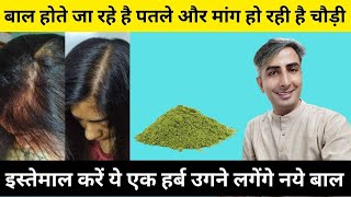 बाल झड़ना रोकें, नए बाल उगाएं 90 दिनों में | Hair Growth Tips | Hair Fall Solution I Dr. Manoj DAs