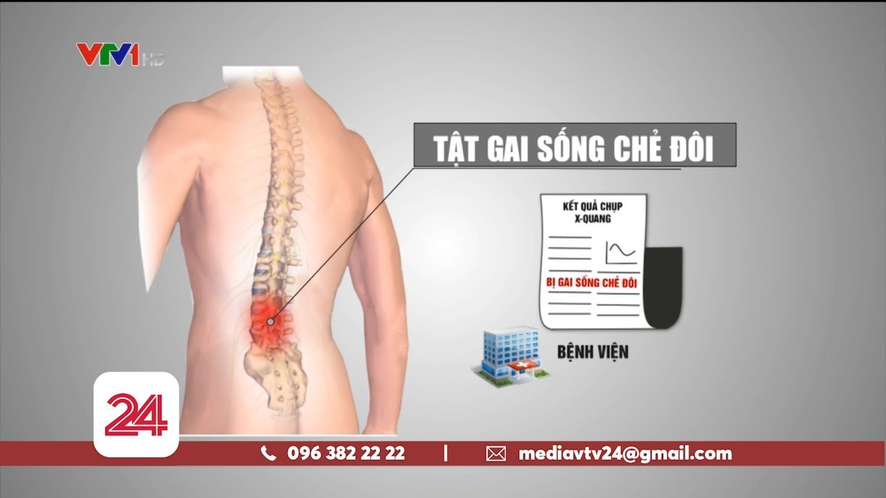 Đường dây làm khống hồ sơ hưởng trợ cấp chất độc hóa... - youtube