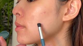 Spatch Invisible Spot Fix For Acne.