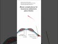 (Rare) complications for transverse abdominis plane blocks