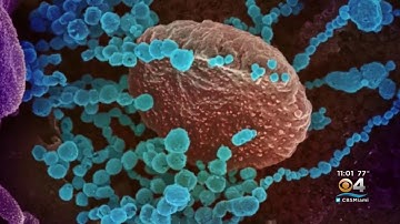 First Omicron Variant Case Detected In Miami-Dade County