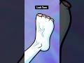 Lack Toes Intolerant 💀 (Animation Meme) #shorts thumbnail