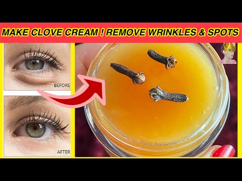 I Made CLOVE CREAM, Applied 7 Nights and Got Rid Of Dark Circles, Wrinkles ! How to Remove Sun-Spots