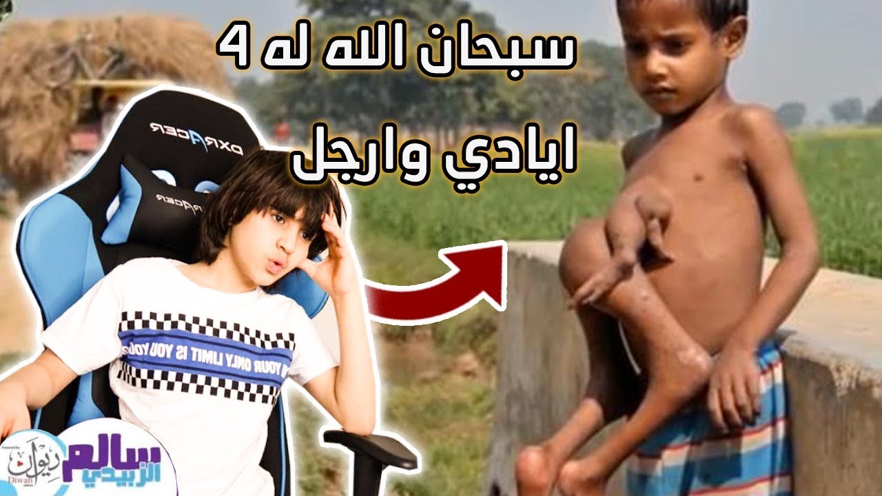 حالات ناس غريبة جداً ، لن تصدق انها حقيقية !! - || حرمة لها قرون 😱 _ #توب_5