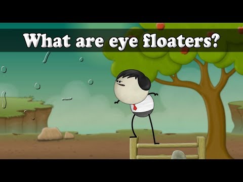 What are eye floaters? | #aumsum #kids #science #education #children