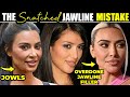 Why jawline filler wont get rid of your jowls do this instead