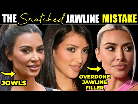 Why Jawline Filler Won't Get Rid of Your Jowls- Do THIS Instead!