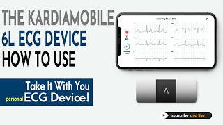 The KardiaMobile 6l | Kardiamobile 6l How To Use