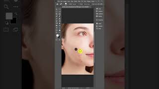 How To Remove Pimple From Your Face   howtoremovepimples shorts ytshorts photoshopediting