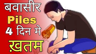 bawasir ka ilaj | bawasir ka ilaj kaise kare | bawasir kyon hoti hai | बवासीर का इलाज