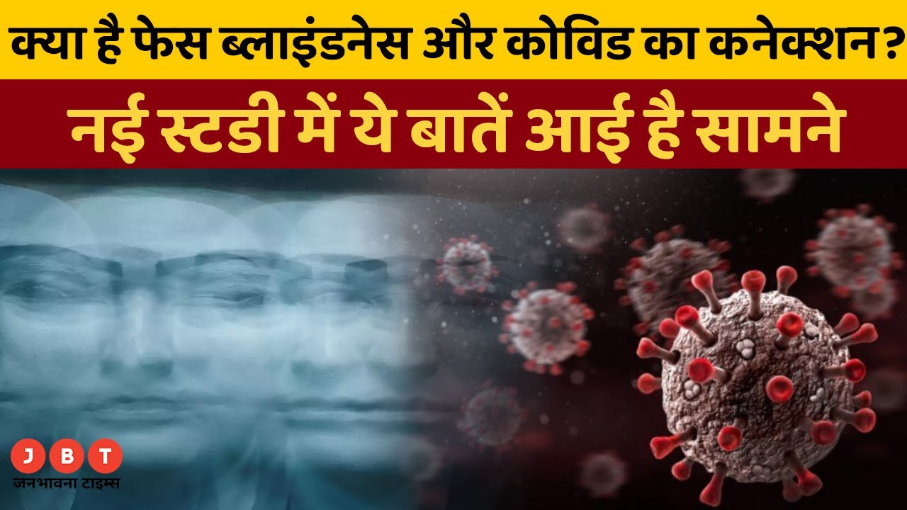 Prolonged Covid19 infection may cause Face Blindness says New Study