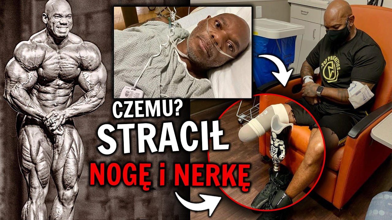 Historia Kulturysty, Który Oszukał Śmierć: Niewiarygodne Przetrwanie.