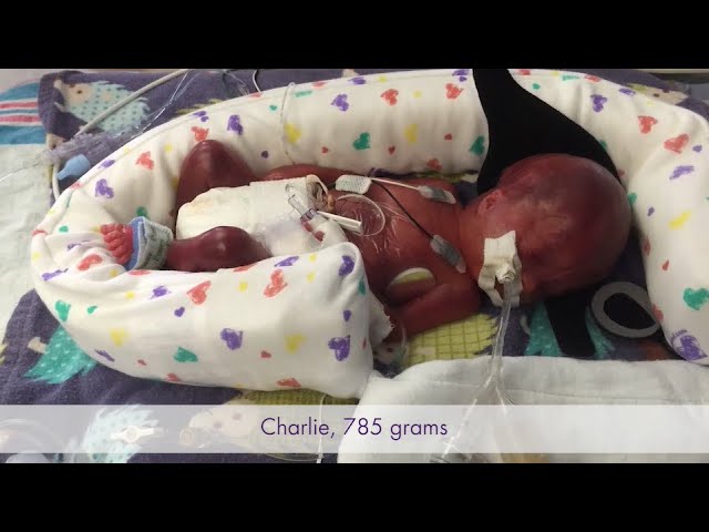 The Gardner Story Baby Charlie Born At 25 Weeks Youtube
