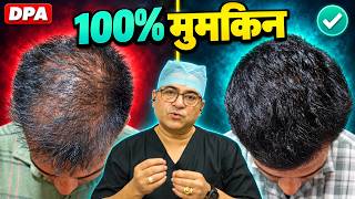 Hairline ठीक, फिर भी बाल पतले? DPA में Transplant कैसे हुआ | Real Client Result