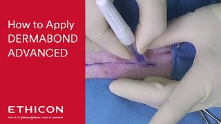 How to Apply DERMABOND ADVANCED Skin Adhesive | ETHICON