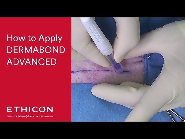 Dermabond Advanced Skin Adhesive