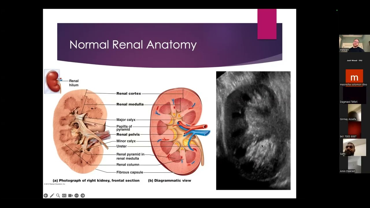 IVUmed VVP: Basics of Procedural Ultrasounds for the Kidney