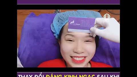 Video cắt mí mini-deep số 7