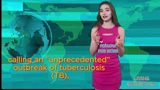 UNPRECEDENTED OUTBREAK OF TUBERCULOSIS