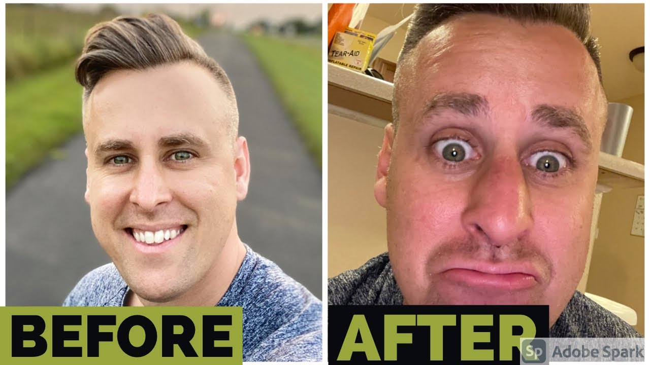 Nose job reveal...IT’S NOT GOOD