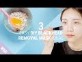 3 Home Remedies For Different Types of Blackhead Concerns | DIY Blackhead Remover Mask