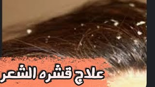 علاج قشره الشعر ورائحه الشعر الكريهه ?