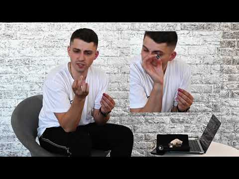 Как фотографировать зубы на телефон? Дентальное фото на смартфон для стоматолога!