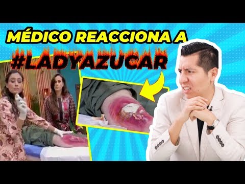 ¡SE CURAN ULCERAS CON AZÚCAR! | MÉDICO REACCIONA A LADY AZÚCAR | PIE DIABETICO