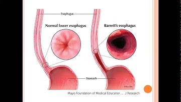JAYOTI VIDYAPEETH gerd video lecture