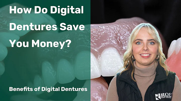 The Benefits of Digital Dentures: How Do Digital Dentures Save You Money?