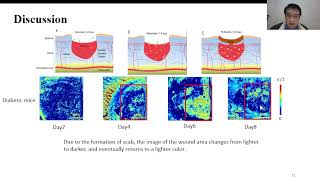 Polarization sensitive optical coherence tomography