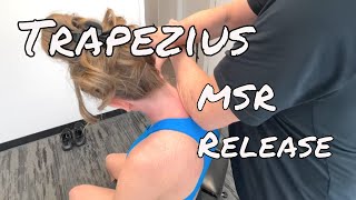 Trapezius Muscle Release - MSR Procedures