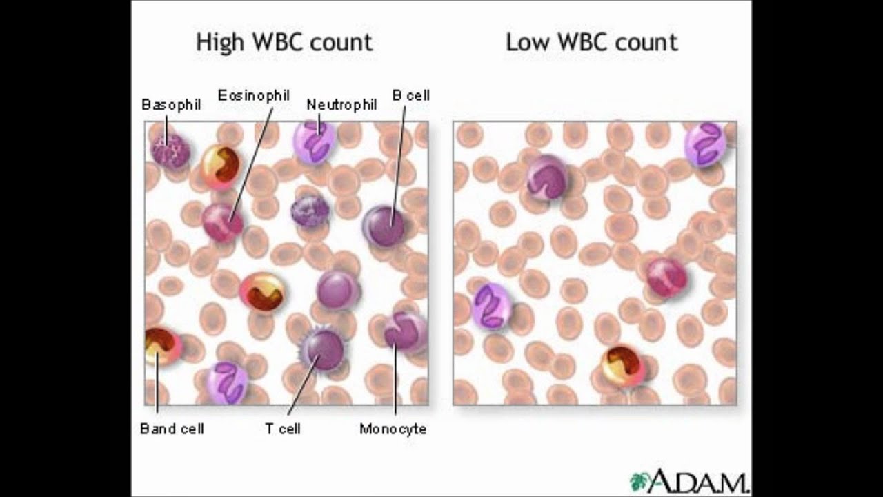 Normal White Blood Cell Count Details Youtube