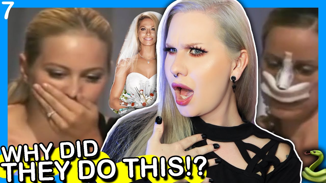 Watch BRIDALPLASTY! Ep. 7 Janessa Plastic Surgery Drama! (SHOCKING) @Luxeria on YouTube Watch BRIDALPLASTY! Ep. 7 Janessa Plastic Surgery Drama! (SHOCKING) @Luxeria on YouTube