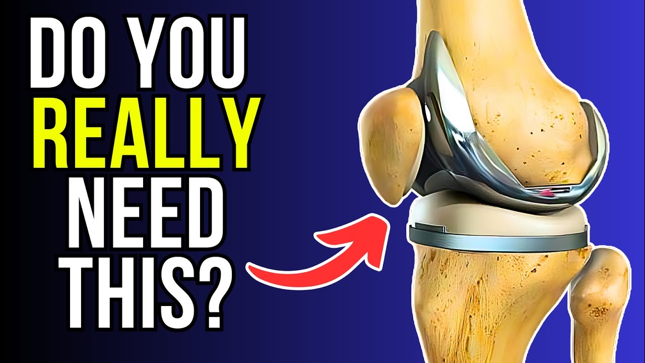 How To Tell If You Need a Knee Replacement - YouTube