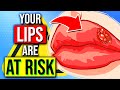 12 Health Warnings Your Lips Are Trying To Tell You