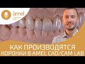 Как производят зубные коронки в Amel CAD/CAM Lab