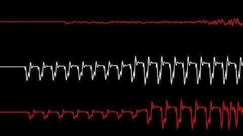 COMMODORE C64 SID - 2020 - 1 2 Polizei (Cover)  - CHRIS-DO / Oscilloscope View
