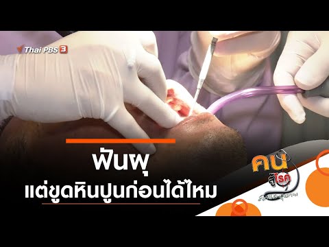 ฟันผุ แต่ขูดหินปูนก่อนได้ไหม : รู้สู้โรค (25 พ.ย. 63)