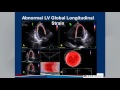 Echocardiographic Assessment of LV Diastolic Function Webinar