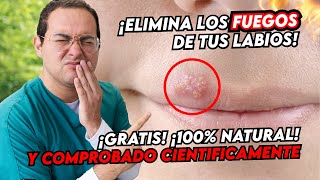 QUITA LOS FUEGOS DE TU BOCA Y LABIOS CON ESTE REMEDIO NATURAL RAPIDO Y FACIL