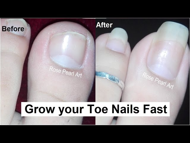 How to Make Your Nails Grow Faster – The Elysian Boutique