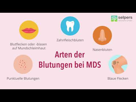 Symptome bei MDS: Blutungen | wie Zahnfleischbluten, Nasenbluten, Blutblasen (Experte erklärt)