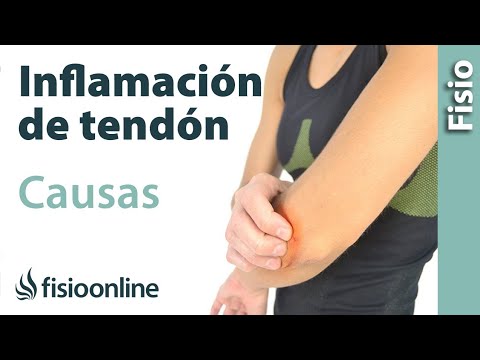 Vídeo: Quina és la causa principal de la tendinitis?